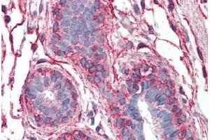 Human Breast: Formalin-Fixed, Paraffin-Embedded (FFPE) (PAK1 anticorps  (AA 191-280))
