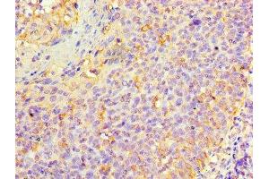 Immunohistochemistry of paraffin-embedded human tonsil tissue using ABIN7157433 at dilution of 1:100