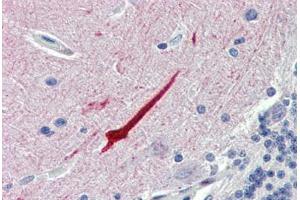Brain, cerebellum, Human: Formalin-Fixed, Paraffin-Embedded (FFPE)