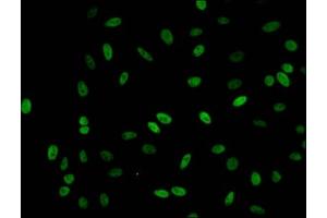 Immunofluorescent analysis of Hela cells (sodium butyrate, 30 mM, 4h) using ABIN7139190 at dilution of 1:100 and Alexa Fluor 488-congugated AffiniPure Goat Anti-Rabbit IgG(H+L)