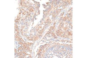 Immunohistochemistry of paraffin-embedded rat ovary using KIF14 antibody (ABIN6129691, ABIN6142854, ABIN6142855 and ABIN6214465) at dilution of 1:100 (40x lens).