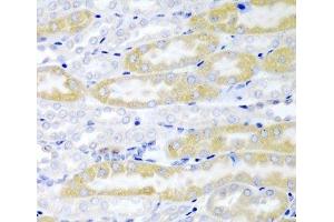 Immunohistochemistry of paraffin-embedded Mouse kidney using FABP6 Polyclonal Antibody at dilution of 1:200 (40x lens). (FABP6 anticorps)