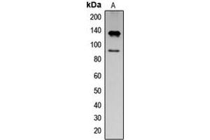 Western blot analysis of IFNAR1 (pY466) expression in K562 EGF-treated (A) whole cell lysates. (IFNAR1 anticorps  (C-Term, pTyr466))