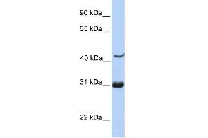 WB Suggested Anti-NUP35 Antibody Titration: 0. (NUP35 anticorps  (C-Term))