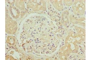 Immunohistochemistry of paraffin-embedded human kidney tissue using ABIN7145914 at dilution of 1:100