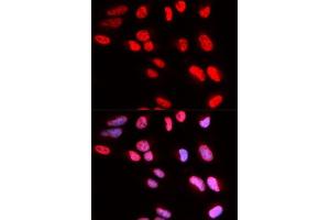 Immunofluorescence analysis of U2OS cells using PRPF3 antibody. (PRPF3 anticorps  (AA 1-280))