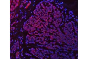 IF analysis of SETD3 using anti-SETD3 antibody (ABIN7600293). (SETD3 anticorps  (AA 173-468))