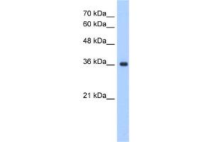 WB Suggested Anti-ELOVL7 Antibody Titration:  1. (ELOVL7 anticorps  (N-Term))