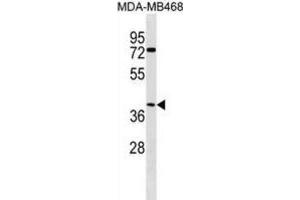 Western Blotting (WB) image for anti-Abhydrolase Domain Containing 1 (ABHD1) antibody (ABIN3000271) (ABHD1 anticorps)