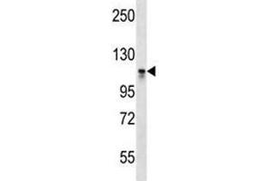 Dnmt3a antibody western blot analysis in CEM lysate.