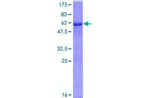 Image no. 1 for TP53 induced glycolysis regulatory phosphatase (TIGAR) (AA 1-270) protein (GST tag) (ABIN1347100)