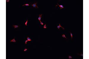 ABIN6269364 staining HepG2 cells by IF/ICC.
