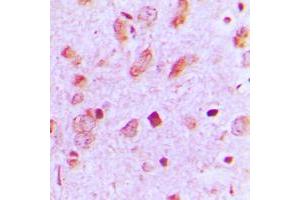 Immunohistochemical analysis of Cytokeratin 13 staining in human brain formalin fixed paraffin embedded tissue section.