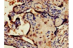 Immunohistochemistry of paraffin-embedded human placenta tissue using ABIN7148675 at dilution of 1:100 (CRTC1 anticorps  (AA 1-248))