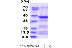 SDS-PAGE (SDS) image for Exosome Component 3 (EXOSC3) (AA 1-275) protein (His tag) (ABIN7280693)