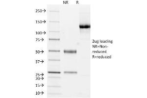 SDS-PAGE Analysis Purified Cytokeratin 10/13 Monoclonal Antibody (DE-K13). (KRT10, KRT13 anticorps)