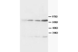 Western Blotting (WB) image for anti-Bridging Integrator 1 (BIN1) (AA 189-398) antibody (ABIN1105531) (BIN1 anticorps  (AA 189-398))