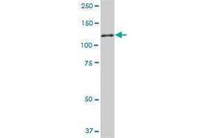 NEK9 monoclonal antibody (M01), clone 1F6.