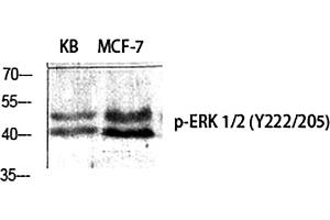 Western Blot analysis of KB(1), MCF-7(2), diluted at 1:500.