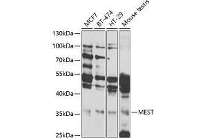 Western blot analysis of extracts of various cell lines, using MEST antibody (ABIN6133292, ABIN6143749, ABIN6143751 and ABIN6222673) at 1:1000 dilution. (MEST anticorps  (AA 146-335))