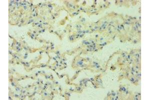 Immunohistochemistry of paraffin-embedded human lung tissue using ABIN7168147 at dilution 1:100 (RRM2B anticorps  (AA 1-351))