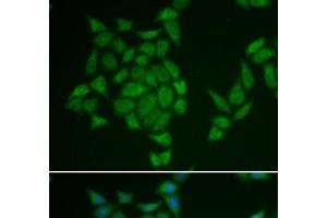 Immunofluorescence analysis of HeLa cells using AMPD3 Polyclonal Antibody