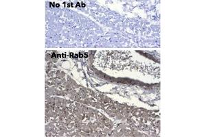 Immunohistochemistry (IHC) image for anti-RAB5A, Member RAS Oncogene Family (RAB5A) (C-Term) antibody (ABIN1440056)