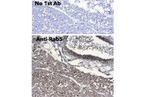 Immunohistochemistry (IHC) image for anti-RAB5A, Member RAS Oncogene Family (RAB5A) (C-Term) antibody (ABIN1440056) (RAB5 anticorps  (C-Term))