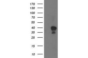 Western Blotting (WB) image for anti-NudE Nuclear Distribution E Homolog (A. Nidulans)-Like 1 (NDEL1) antibody (ABIN1499854) (NDEL1 anticorps)