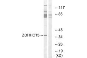 Western blot analysis of extracts from Jurkat cells, using ZDHHC15 Antibody.