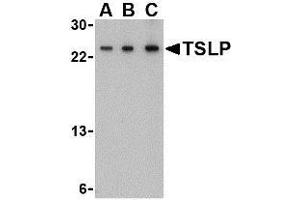 Western blot analysis of TSLP in A-20 cell lysate with TSLP antibody at (A) 0. (Thymic Stromal Lymphopoietin anticorps)