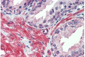 Human Prostate: Formalin-Fixed, Paraffin-Embedded (FFPE)