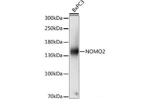 Western blot analysis of extracts of BxPC3 cells using NOMO2 Polyclonal Antibody at dilution of 1:1000. (NOMO2 anticorps)