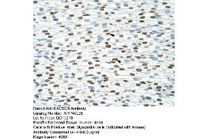 Rabbit Anti-EXOSC4 Antibody  Paraffin Embedded Tissue: Human Heart Cellular Data: Myocardial cells Antibody Concentration: 4.