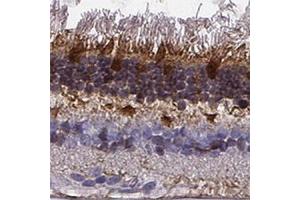 Immunohistochemical staining of human retina shows strong cytoplasmic positivity in photoreceptor layer and outer plexiform layer. (GCAP1 anticorps)