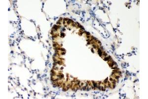 IHC testing of FFPE mouse lung with COMT antibody. (COMT anticorps  (AA 52-271))
