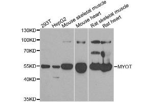 Western blot analysis of extracts of various cell lines, using MYOT antibody. (Myotilin anticorps)