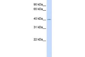 WB Suggested Anti-ACAA2 Antibody Titration:  0. (ACAA2 anticorps  (N-Term))