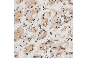 Immunohistochemistry of paraffin-embedded human stomach using KPNA4 Antibody (ABIN5971058) at dilution of 1/200 (40x lens). (KPNA4 anticorps)