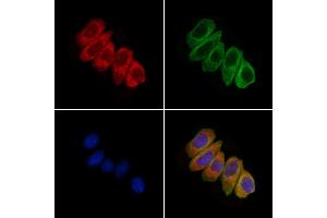 ABIN6259779 and ABIN6279082 staining HepG2 cells by IF/ICC.