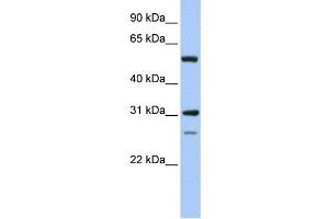 IMPDH1 antibody used at 1 ug/ml to detect target protein. (IMPDH1 anticorps)