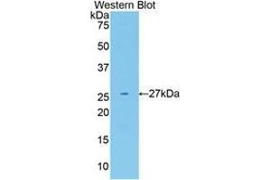 Western blot analysis of the recombinant protein. (Neuregulin 1 anticorps  (AA 20-242))