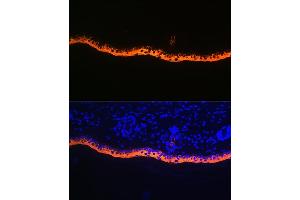 Immunofluorescence analysis of rat skin using Cytokeratin 10 Rabbit mAb (ABIN1679404, ABIN3019133, ABIN3019134 and ABIN7101721) at dilution of 1:100 (40x lens). (Keratin 10 anticorps)