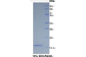 SDS-PAGE of Protein Standard from the Kit (Highly purified E.