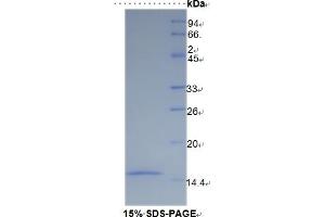 SDS-PAGE of Protein Standard from the Kit (Highly purified E. (SLC30A8 Kit ELISA)