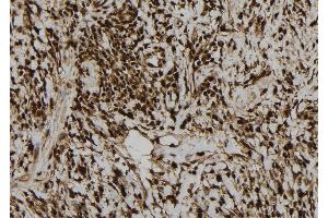 ABIN6276940 at 1/100 staining Human gastric tissue by IHC-P. (LIG3 anticorps  (Internal Region))