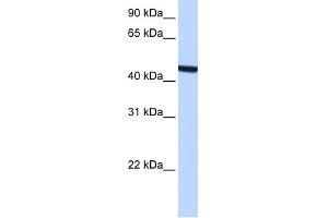 WB Suggested Anti-ZCCHC3 Antibody Titration:  0. (ZCCHC3 anticorps  (Middle Region))