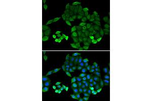 Immunofluorescence analysis of MCF-7 cells using PTS antibody (ABIN5973727). (PTS anticorps)