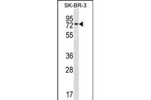 MBD4 Antibody (Center) (ABIN1881532 and ABIN2838378) western blot analysis in SK-BR-3 cell line lysates (35 μg/lane). (MBD4 anticorps  (AA 323-351))