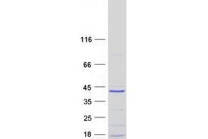 Validation with Western Blot